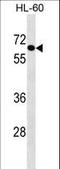 Crystallin Beta-Gamma Domain Containing 2 antibody, LS-C156194, Lifespan Biosciences, Western Blot image 