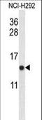 Ubiquinol-Cytochrome C Reductase Binding Protein antibody, LS-C160453, Lifespan Biosciences, Western Blot image 