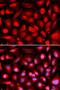 ETS Proto-Oncogene 1, Transcription Factor antibody, LS-C748358, Lifespan Biosciences, Immunofluorescence image 