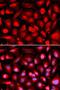 ETS Proto-Oncogene 1, Transcription Factor antibody, LS-C748358, Lifespan Biosciences, Immunofluorescence image 