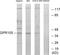 P2Y purinoceptor 14 antibody, LS-C120603, Lifespan Biosciences, Western Blot image 