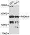 PR/SET Domain 16 antibody, abx127014, Abbexa, Western Blot image 