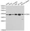 Cyclin Dependent Kinase 9 antibody, A1564, ABclonal Technology, Western Blot image 