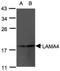 Laminin Subunit Alpha 4 antibody, NBP1-32159, Novus Biologicals, Western Blot image 