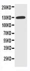Solute Carrier Family 12 Member 2 antibody, PA2169, Boster Biological Technology, Western Blot image 