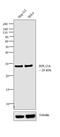 Ribosomal Protein L13a antibody, PA5-17176, Invitrogen Antibodies, Western Blot image 
