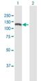 Cell Migration Inducing Hyaluronidase 1 antibody, H00057214-B01P, Novus Biologicals, Western Blot image 