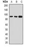 Plasma protease C1 inhibitor antibody, abx142218, Abbexa, Western Blot image 