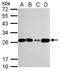 Transcription Factor A, Mitochondrial antibody, GTX103231, GeneTex, Western Blot image 