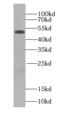 Secretogranin III antibody, FNab07699, FineTest, Western Blot image 