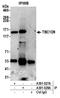 TBC1 Domain Family Member 9 antibody, A301-028A, Bethyl Labs, Immunoprecipitation image 