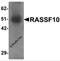 Ras association domain-containing protein 10 antibody, 6371, ProSci, Western Blot image 
