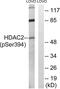 Histone Deacetylase 2 antibody, LS-C117369, Lifespan Biosciences, Western Blot image 