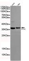 Protein Phosphatase 4 Catalytic Subunit antibody, STJ99049, St John