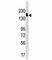 SET Domain Bifurcated Histone Lysine Methyltransferase 1 antibody, F40900-0.4ML, NSJ Bioreagents, Western Blot image 