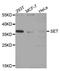 SET Nuclear Proto-Oncogene antibody, A6212, ABclonal Technology, Western Blot image 