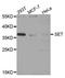 Protein SET antibody, A6212, ABclonal Technology, Western Blot image 