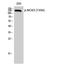 Nitric Oxide Synthase 3 antibody, A01604T494-1, Boster Biological Technology, Western Blot image 