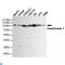 Hexokinase 1 antibody, LS-C812992, Lifespan Biosciences, Western Blot image 