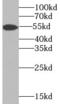 Transmembrane protease serine 4 antibody, FNab08806, FineTest, Western Blot image 