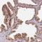 Polyhomeotic Homolog 2 antibody, HPA047403, Atlas Antibodies, Immunohistochemistry frozen image 