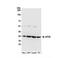 Eukaryotic Translation Initiation Factor 4E antibody, NB100-58833, Novus Biologicals, Western Blot image 