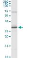 Peroxiredoxin 3 antibody, H00010935-M01, Novus Biologicals, Immunoprecipitation image 