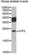 Activating Transcription Factor 3 antibody, LS-C748519, Lifespan Biosciences, Western Blot image 