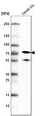 Neurofilament Light antibody, AMAb91314, Atlas Antibodies, Western Blot image 