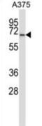 Protein Phosphatase 3 Catalytic Subunit Alpha antibody, abx027586, Abbexa, Western Blot image 