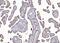 EPH Receptor A3 antibody, A02872-1, Boster Biological Technology, Immunohistochemistry paraffin image 