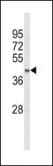 Acyl-CoA Dehydrogenase Long Chain antibody, LS-C155903, Lifespan Biosciences, Western Blot image 