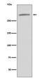 Von Willebrand Factor antibody, M00270-1, Boster Biological Technology, Western Blot image 