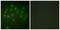 Vitamin D Receptor antibody, LS-C199727, Lifespan Biosciences, Immunofluorescence image 