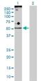 ADP Dependent Glucokinase antibody, H00083440-D01P, Novus Biologicals, Western Blot image 