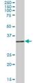 Acyl-CoA Thioesterase 8 antibody, H00010005-B01P, Novus Biologicals, Western Blot image 