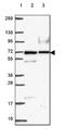 Poly [ADP-ribose] polymerase 3 antibody, NBP2-49523, Novus Biologicals, Western Blot image 