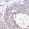 Ankyrin Repeat Domain 45 antibody, NBP1-85421, Novus Biologicals, Immunohistochemistry paraffin image 