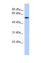 Glutamate dehydrogenase 1, mitochondrial antibody, NBP1-54961, Novus Biologicals, Western Blot image 