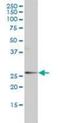 Alpha-1-acid glycoprotein antibody, orb94723, Biorbyt, Western Blot image 