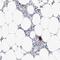 Integrin Subunit Alpha 2b antibody, NBP1-84580, Novus Biologicals, Immunohistochemistry frozen image 