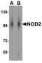 Nucleotide Binding Oligomerization Domain Containing 2 antibody, A00087-1, Boster Biological Technology, Western Blot image 