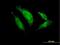T-Box 20 antibody, H00057057-B01P, Novus Biologicals, Immunocytochemistry image 