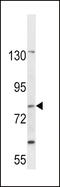 Solute Carrier Family 15 Member 1 antibody, 57-797, ProSci, Western Blot image 