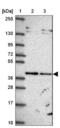 Translocase Of Inner Mitochondrial Membrane 50 antibody, NBP2-38791, Novus Biologicals, Western Blot image 