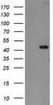 TBC1 Domain Family Member 21 antibody, TA503742, Origene, Western Blot image 