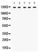 Transient Receptor Potential Cation Channel Subfamily M Member 8 antibody, PB9837, Boster Biological Technology, Western Blot image 