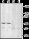 Adrenoceptor Beta 3 antibody, GTX18152, GeneTex, Western Blot image 