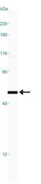 Methionine Adenosyltransferase 2A antibody, NB110-94162, Novus Biologicals, Western Blot image 