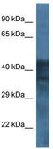Gamma-Aminobutyric Acid Type A Receptor Beta1 Subunit antibody, TA329170, Origene, Western Blot image 
